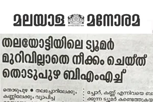 News about Endoscopic Orbital Transposition for Skull base tumor.