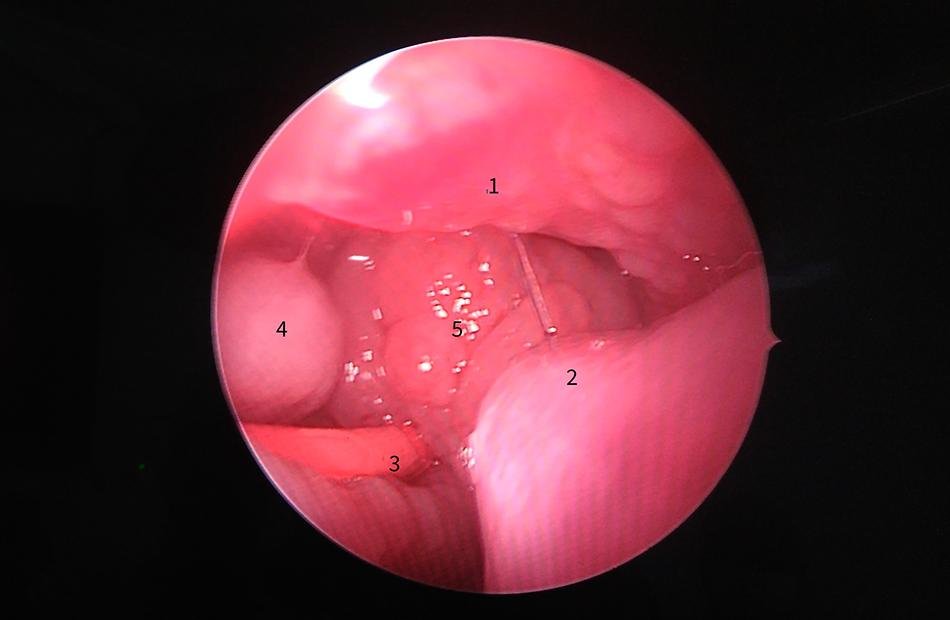 ENT Quiz – Challenging diagnostic nasal imaging