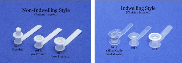 Tracheoesophageal Prosthesis (TEP Speech)