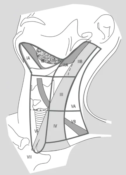 Anatomic diagram of the neck depicting the boundaries of the 6 neck levels and 3 neck sublevels.