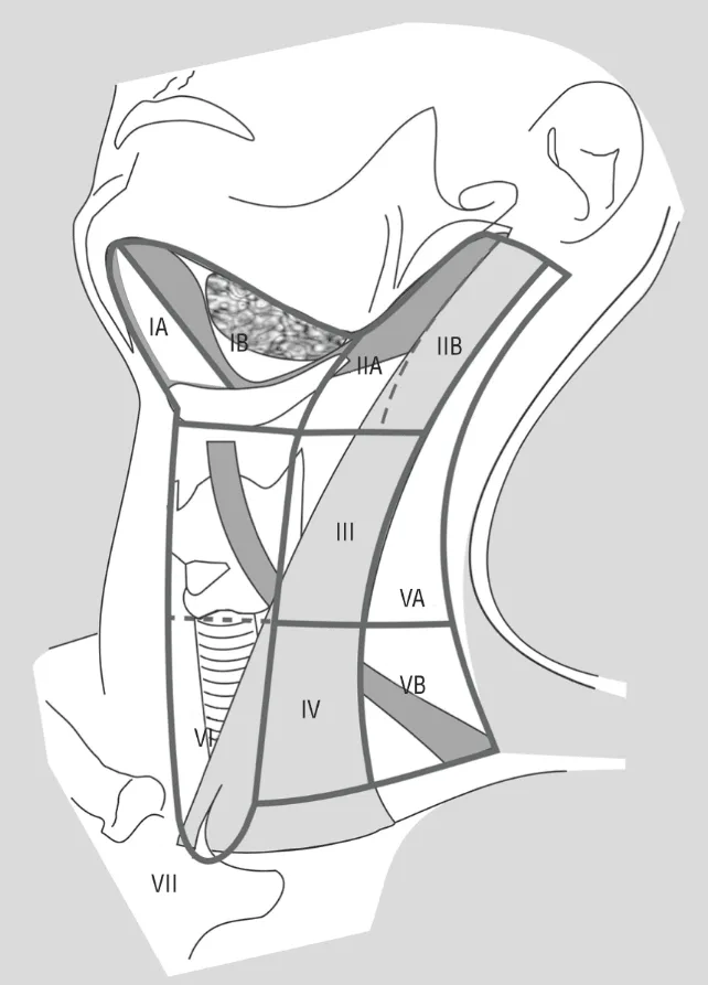 Anatomic diagram of the neck depicting the boundaries of the 6 neck levels and 3 neck sublevels.