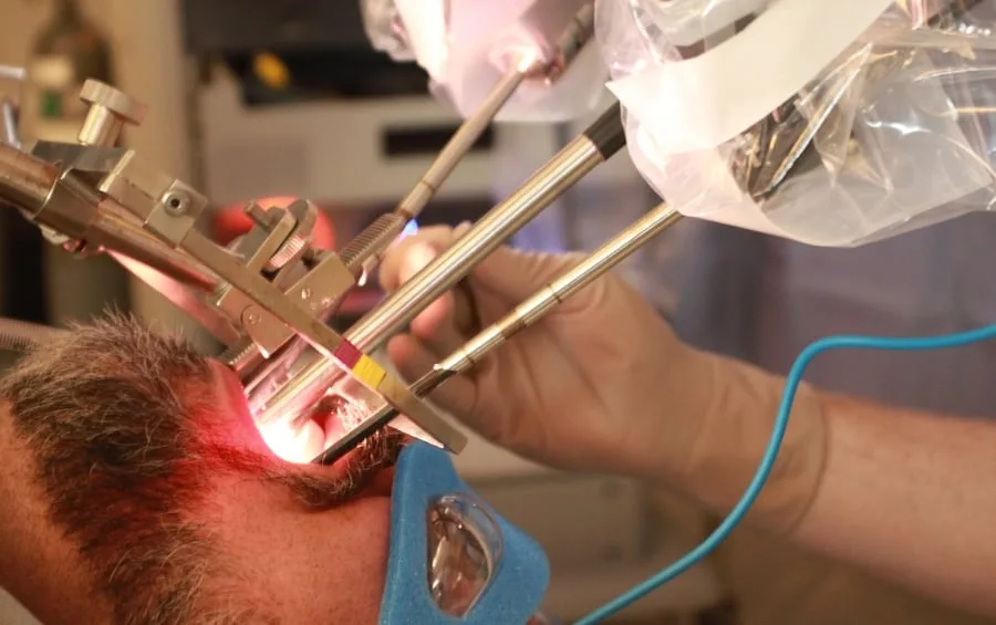 Radiotherapy is better than TORS for Oropharyngeal Cancers – ORATOR Says