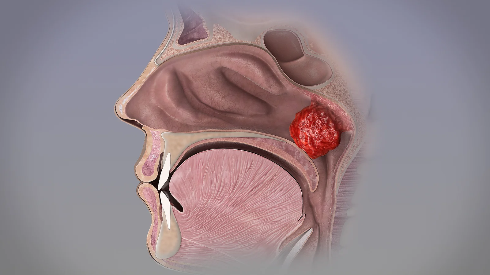 Illustrated are the components of Waldeyerâ€™s ring of lymphoid tissue:...  | Download Scientific Diagram