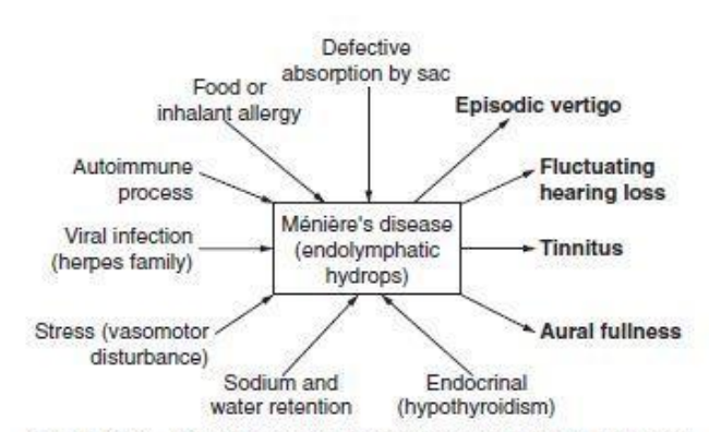 Etiological factors and Symptomatology of Meniere's Disease
