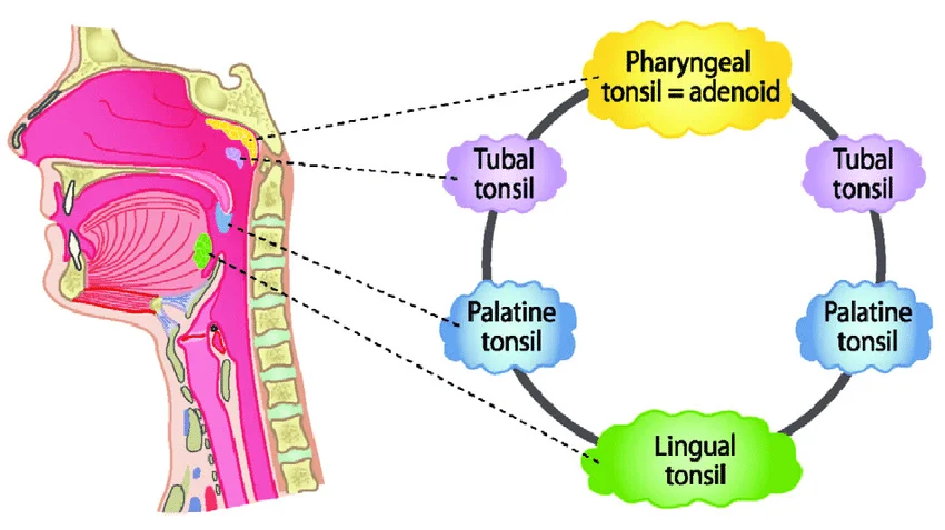 Tonsillitis - Don't Forget the Bubbles