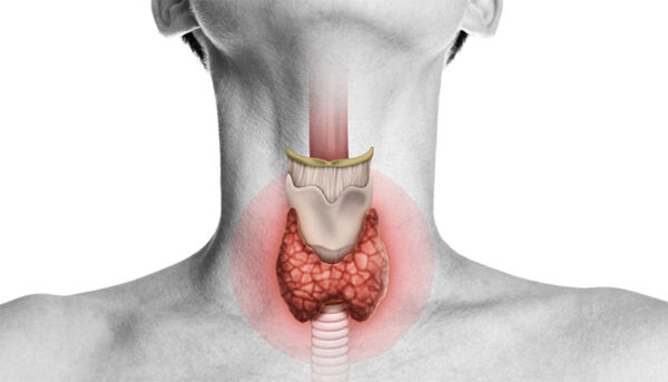 Thyroid Surgery: A Comprehensive Guide for Patients