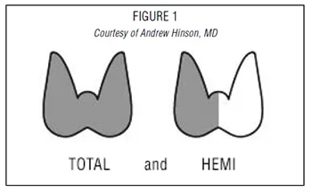 Types of thyroidectomies