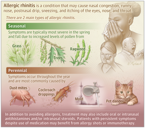 Allergic Rhinitis InfoGraphic - Courtesy JAMA