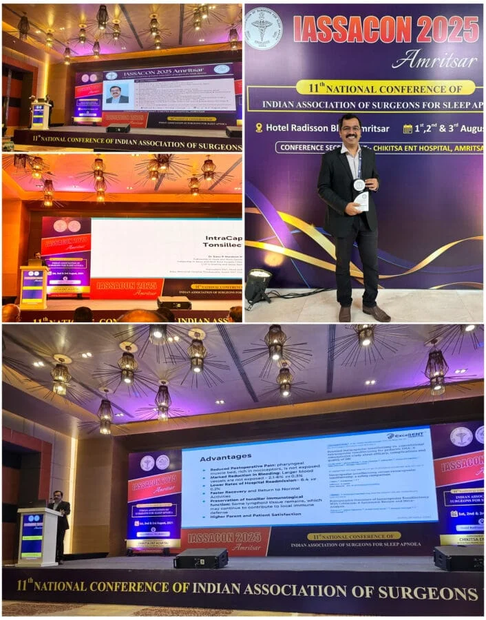 As a faculty for the 11th National Conference of Indian Association of Surgeons for Sleep Apnea, Amritsar - 01,02,03 August 2025